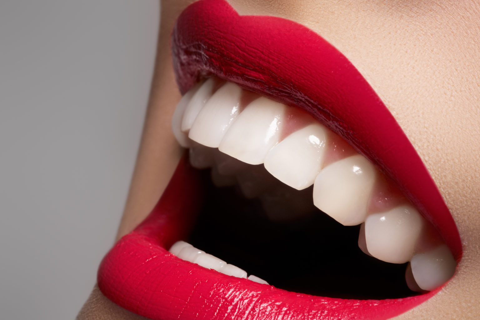 smile teeth whitening kiosk